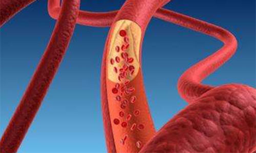 ���̴�����ʲôΣ�� �ܵ��̴�ƫ�ߵ�ԭ��